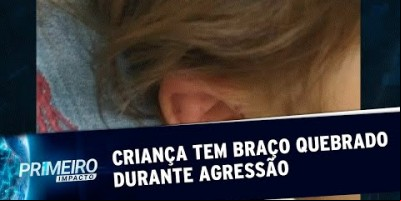 Criança de 3 anos, vítima de maus-tratos, é encontrada após denúncias | Primeiro...